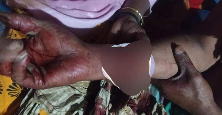 সাংবাদিক বিল্লাল হোসেনের উপর সন্ত্রাসী হামলা