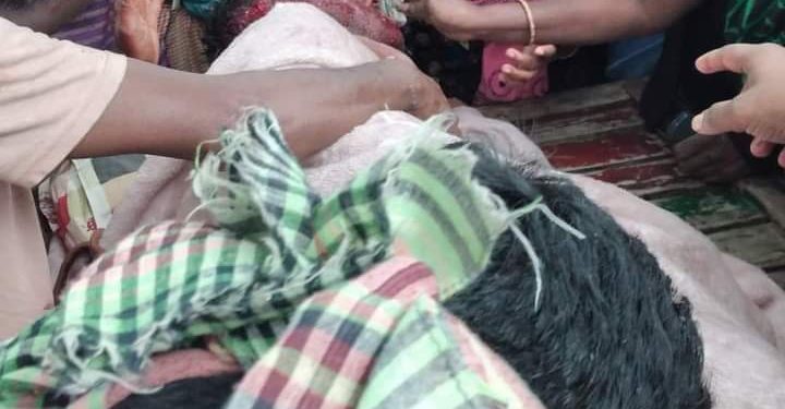 শরিয়তপুর জাজিরায় বোমা বানাতে গিয়ে বিস্ফোরণে যুবক আহত।