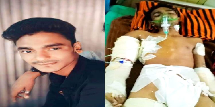 নির্বাচনী বিরোধের জেরে শার্শায় যুবককে কুপিয়ে জখম