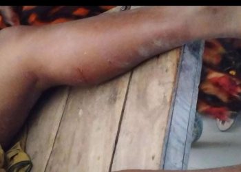 বাগমারায় পুকুর খনন বন্ধে অভিযোগ দেয়ায় পিটিয়ে জখমের অভিযোগ