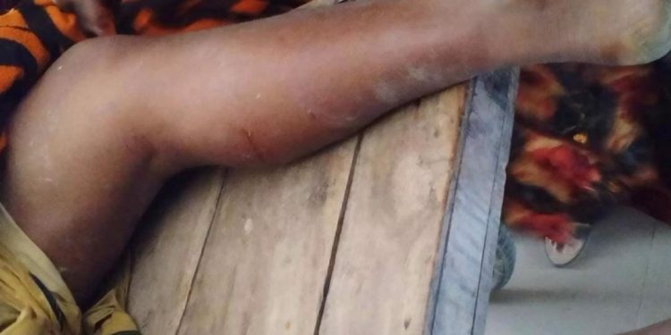 বাগমারায় পুকুর খনন বন্ধে অভিযোগ দেয়ায় পিটিয়ে জখমের অভিযোগ