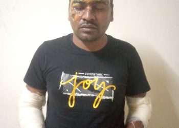 নরসিংদীর মাধবদীতে গরম পানি ঢেলে হত্যার চেষ্টা