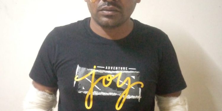 নরসিংদীর মাধবদীতে গরম পানি ঢেলে হত্যার চেষ্টা