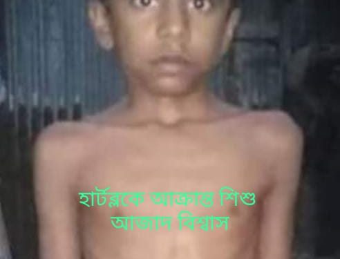 আমি বাঁচতে চাই আপনারা আমারে বাঁচান