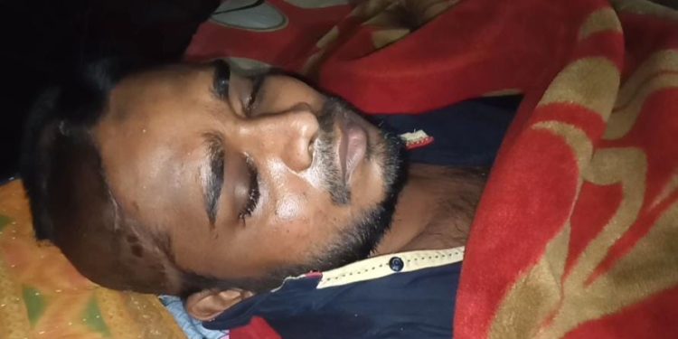 শার্শায় বিদ্যুৎস্পৃষ্ঠে ঝলসে যাওয়া মোস্তফাকে বাঁচাতে মানবিক সাহায্যের আবেদন