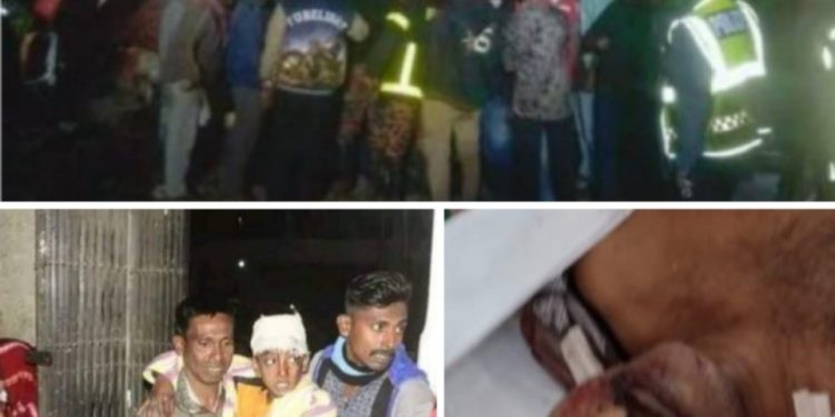 বাঘারপাড়ার বাকড়ী এগারোখানে শোকের ছায়া পিকনিকের বাস দুর্ঘটনায় নিহত-৩ আহত-৪০