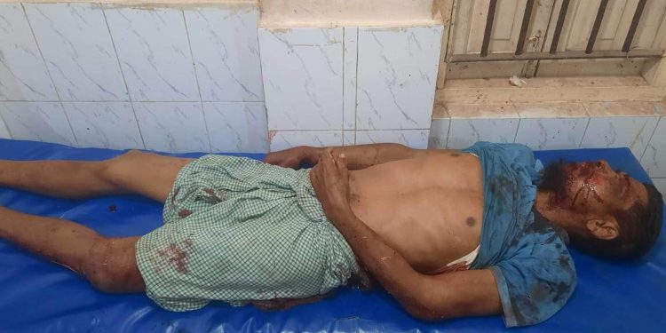 নাটোরে ভাইয়ের গাছে চুরি করতে গিয়ে ভাইয়ের মৃত্যু