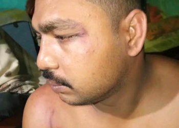 নড়াইলে সংবাদ সংগ্রহ করতে গিয়ে হামলা শিকার সাংবাদিক তরিকুল