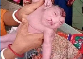 ডুমুরিয়ায় অদ্ভুত আকৃতির শিশুর জন্ম
