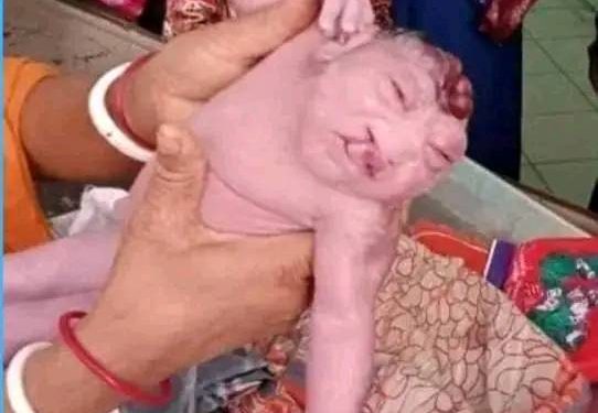 ডুমুরিয়ায় অদ্ভুত আকৃতির শিশুর জন্ম