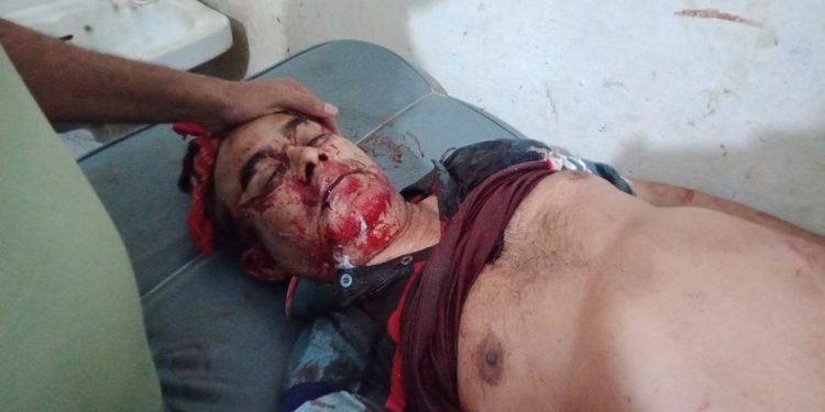 শার্শায় মোটরসাইকেলের ধাক্কায় পথচারী এ্যাডভোকেট মাহবুবুর হাসান নিহত 