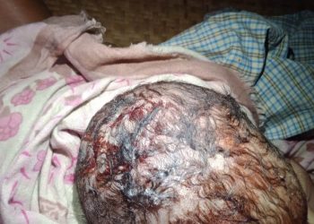 বাঁশখালীতে হাতুরে ডাক্তারের ভুল চিকিৎসায় এক নবজাতক শিশুর মৃত্যু