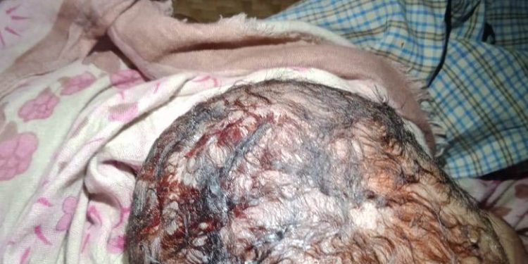 বাঁশখালীতে হাতুরে ডাক্তারের ভুল চিকিৎসায় এক নবজাতক শিশুর মৃত্যু