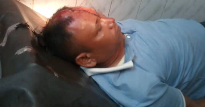 পূর্ব শত্রুতার জের ধরে প্রতিপক্ষেক হামলায় আহত এক রংপুর মেডিকেল ভর্তি।