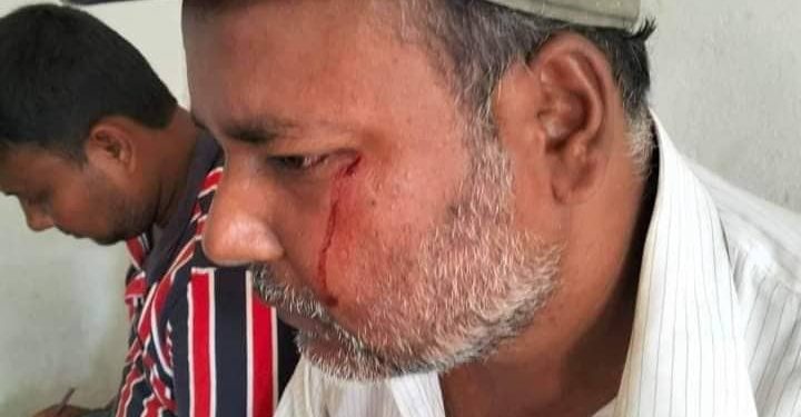 রংপুরে বাড়িতে ঢুকে সাংবাদিকের উপর হামলা, থানায় মামলা।