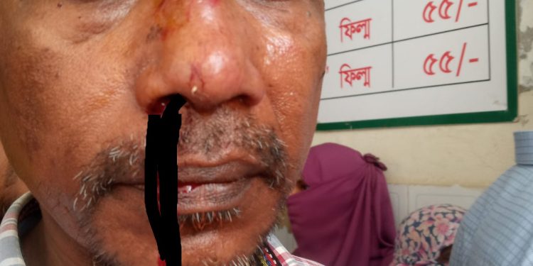 নরসিংদীতে ইউপি মেম্বার কর্তৃক প্রবাসীর বাড়ীর কেয়ার টেকারকে মারধর ও চাবি ছিনতাই 