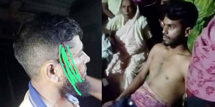 পটুয়াখালীতে বর পক্ষের সন্ত্রাসী হামলা, আহত -২