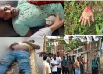 রাসিক নির্বাচনোত্তর সহিংসতায় হাতের কব্জি বিচ্ছিন্নসহ চারজন হাসপাতালে