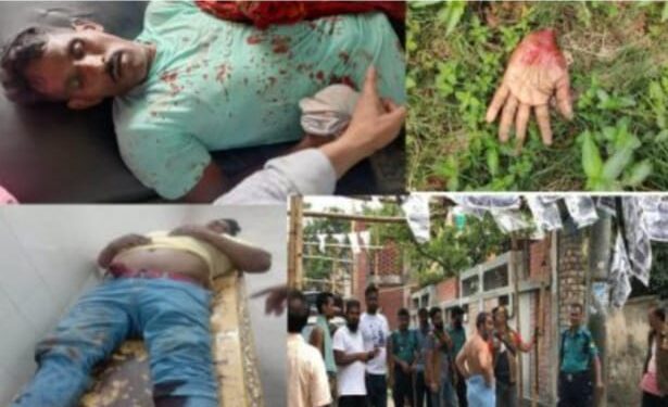রাসিক নির্বাচনোত্তর সহিংসতায় হাতের কব্জি বিচ্ছিন্নসহ চারজন হাসপাতালে