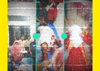 কলাপাড়ায় সৎ চাচা কর্তৃক ভাতিজার হাত পায়ের রগ কর্তন,থানায় মামলা