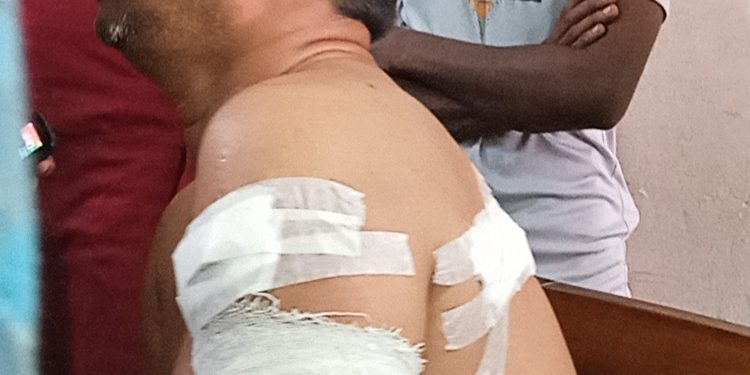 পটুয়াখালীতে মনোনয়ন দাখিলকে কেন্দ্র করে স্বতন্ত্র প্রার্থী মাহবুব অনুসারী দুই নেতাকে কুপিয়ে জখমের অভিযোগ