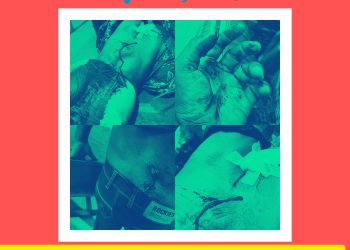 নেত্রকোনায় জমি সংক্রান্ত বিরোধে একই পরিবারের ৪ জন আহত