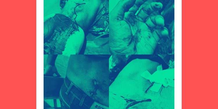 নেত্রকোনায় জমি সংক্রান্ত বিরোধে একই পরিবারের ৪ জন আহত