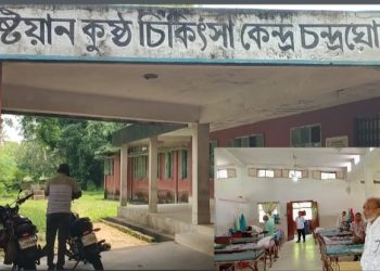 “চন্দ্রঘোনা শতবর্ষী কুষ্ঠ চিকিৎসা কেন্দ্র  অর্থনৈতিক সংকটে বন্ধের পথে” বিত্তবান দেশওবিদেশে এনজিওদের এগিয়ে আসার দাবি স্থানীয়দের