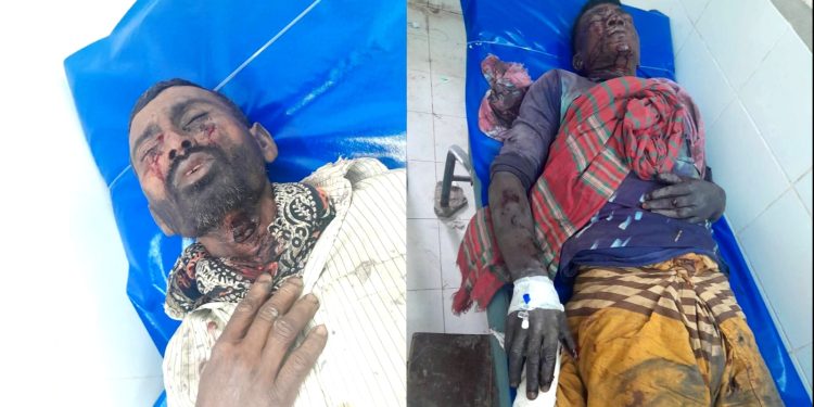 শার্শার বালুন্ডায় ককটেল বিস্ফোরণে দুইজন শ্রমিক আহত